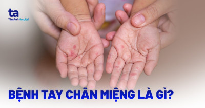BỆNH TAY CHÂN MIỆNG